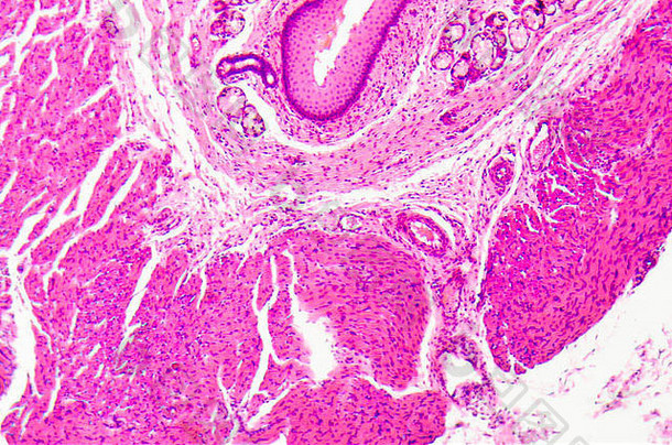 医学分层鳞状上皮组织细胞显微照片