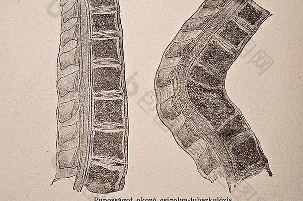 脊椎的古代医学插图