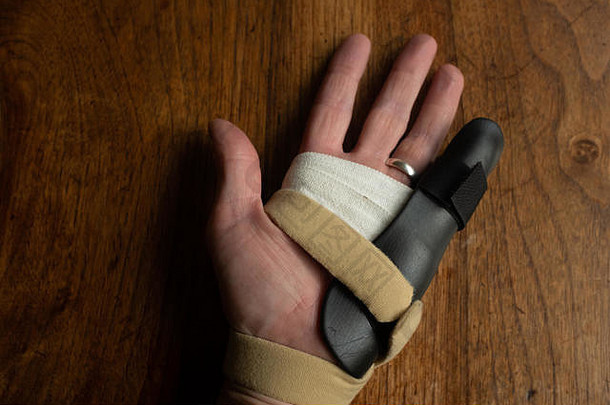 一名患者在针状腱膜切开术后用夹板固定手指以解除Dupuytren挛缩