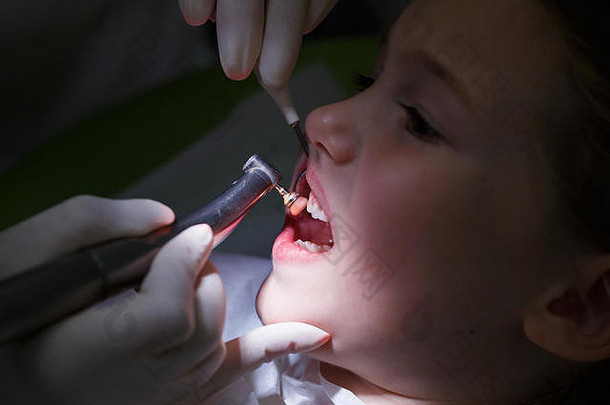 女孩儿科牙医办公室<strong>牙齿</strong>抛光预防粘贴牙医早期预防口服卫生恐惧