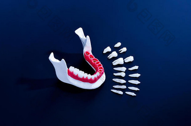 在蓝色背景上隔离牙齿种植和牙冠过程。医学上精确的3D插图