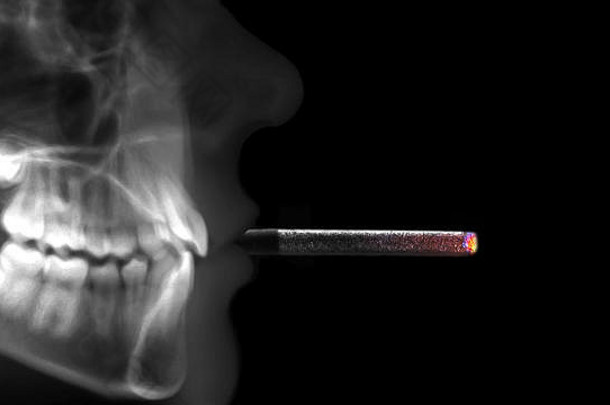 人类x射线吸烟香烟