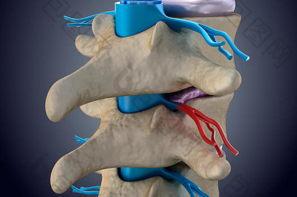脊髓绳压力膨胀阀瓣