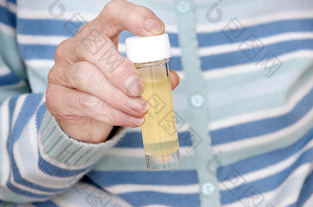上了年纪的女人无菌通用容器尿液标本准备好了分析