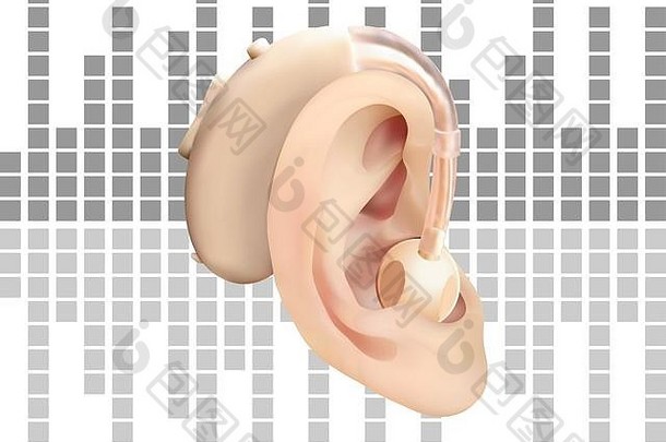 数字听力援助耳朵背景声音波图治疗假肢听力损失耳鼻咽喉科现实的