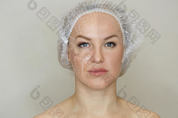 non-surgical脸提升sma材料提升超声波整容过程复兴水疗中心治疗硬件美容