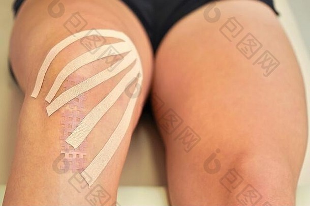 运动机能学磁带身体颜色减少薄条纹应用膝盖女病人特写镜头细节