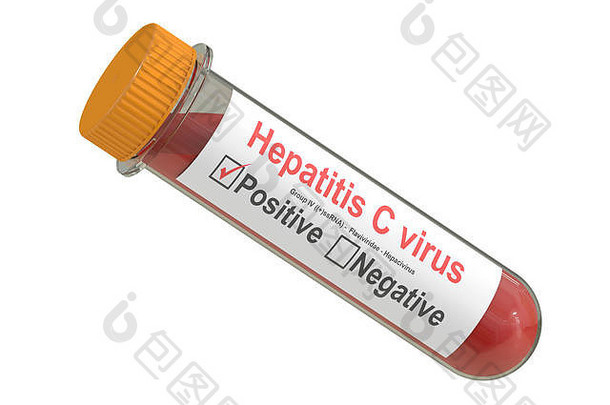 测试管血样本积极的肝炎病毒呈现孤立的白色背景