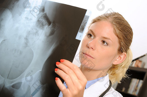 女医生检查x射线图像