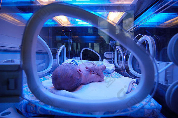 出生不成熟的婴儿孵化器新生儿密集的护理单位镍氢