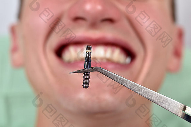 牙科植入物镊子微笑病人背景