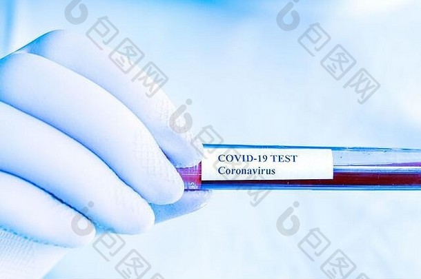 冠状病毒测试实验室科维德手臂塑料手套持有测试管测试样本实验室手细节蓝色的语气过滤器