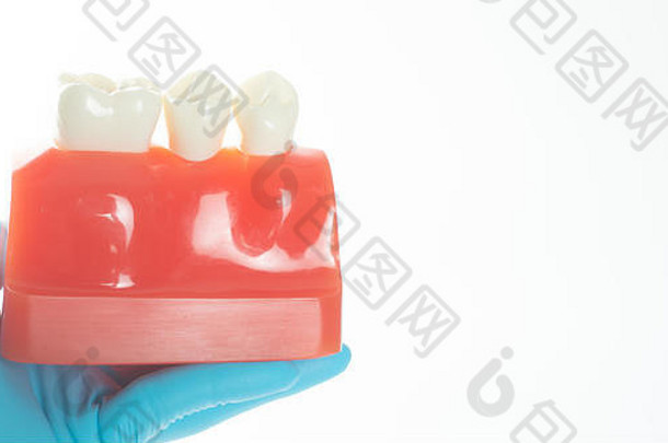 样本牙科模型植入物取代牙删除预览冠牙医的手显示样本