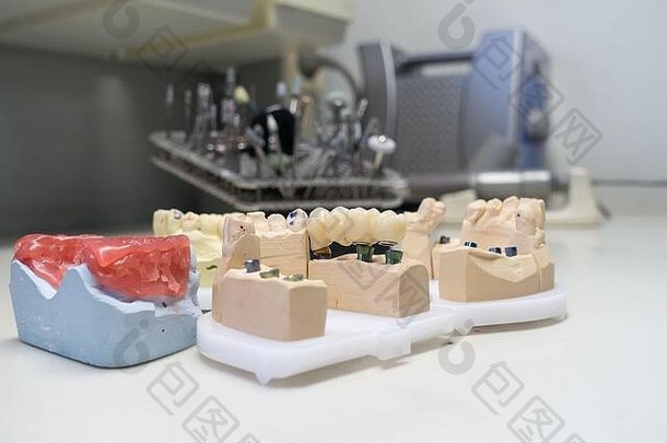 氧化锆牙科冠牙科模型牙科实验室