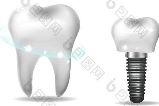牙科植入物假肢现实的风格牙科健康的牙齿概念向量插图