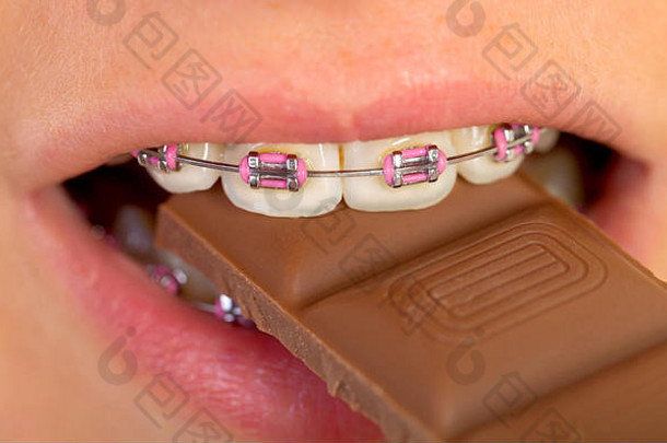 女孩粉红色的牙套吃巧克力