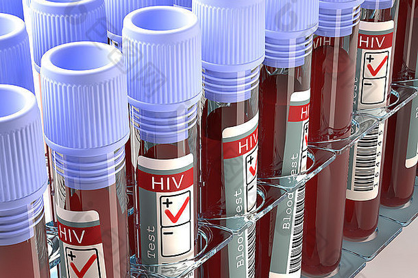 图像概念结果艾滋病毒测试