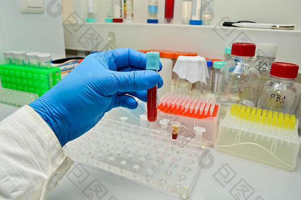 <strong>实验室</strong>研究血手测试管背景科学设备
